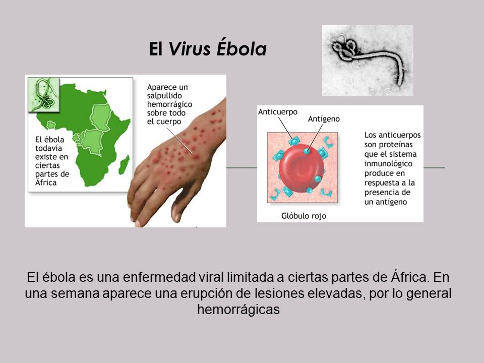 El complejo de los ejercicios a la osteocondrosis del departamento lumbosacro